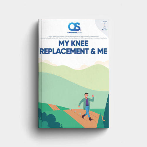 knee replacement